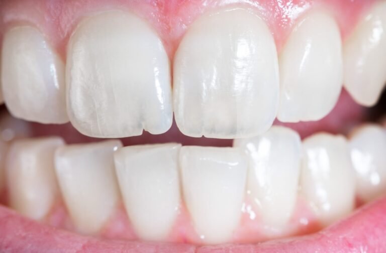 how to fix a cracked tooth naturally​
