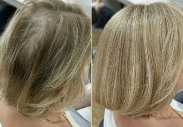 65% of Women Over 40 Will Experience Hair Thinning: So Why Is Nobody in the Beauty Industry Actually Talking to Them?